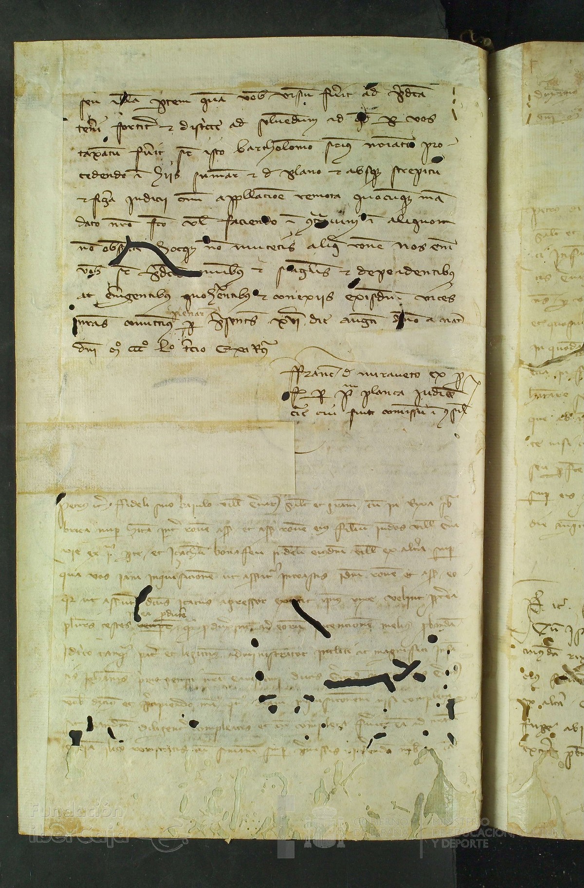 151v