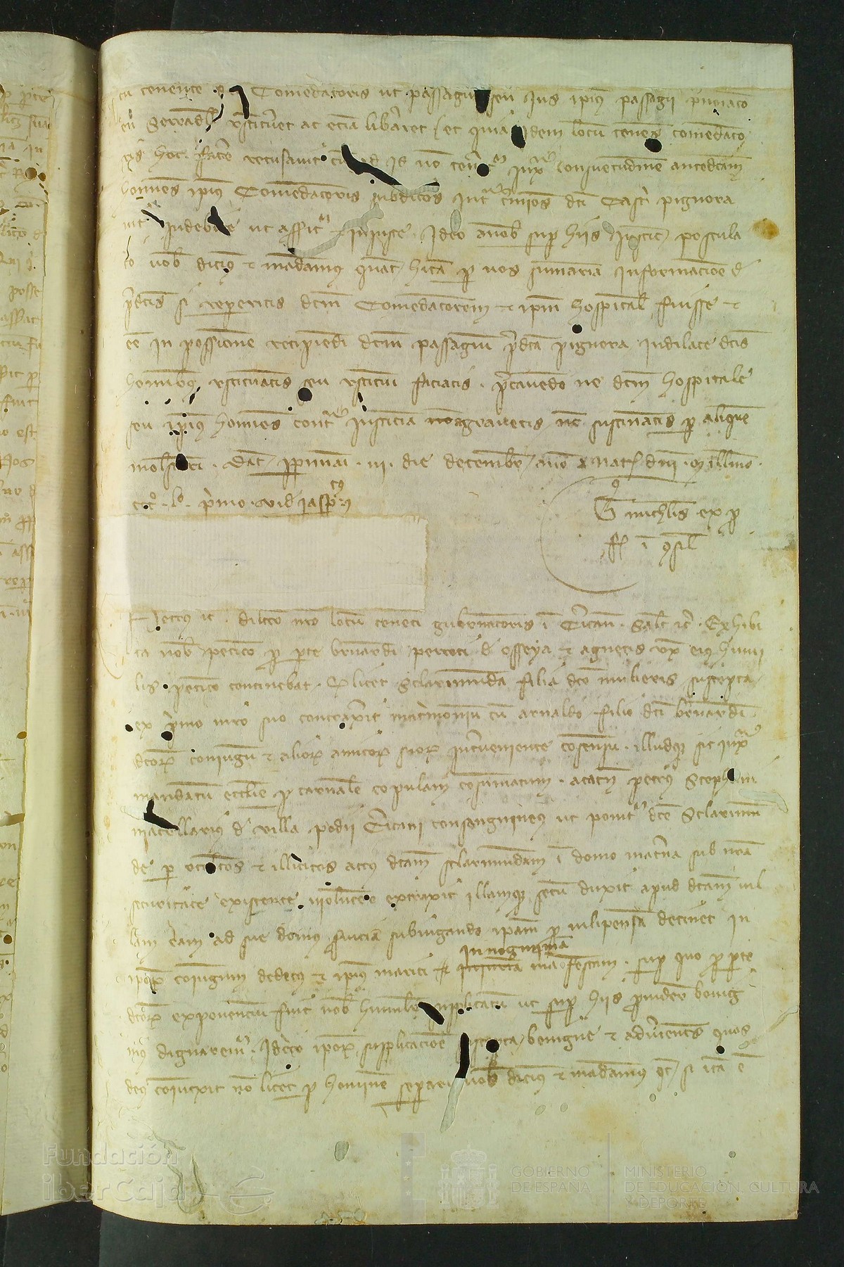 151r